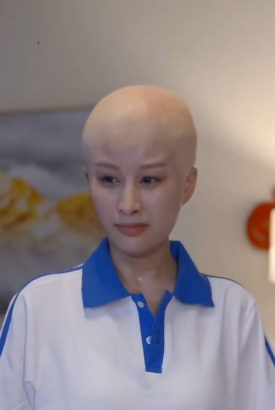 秃女 秃女
